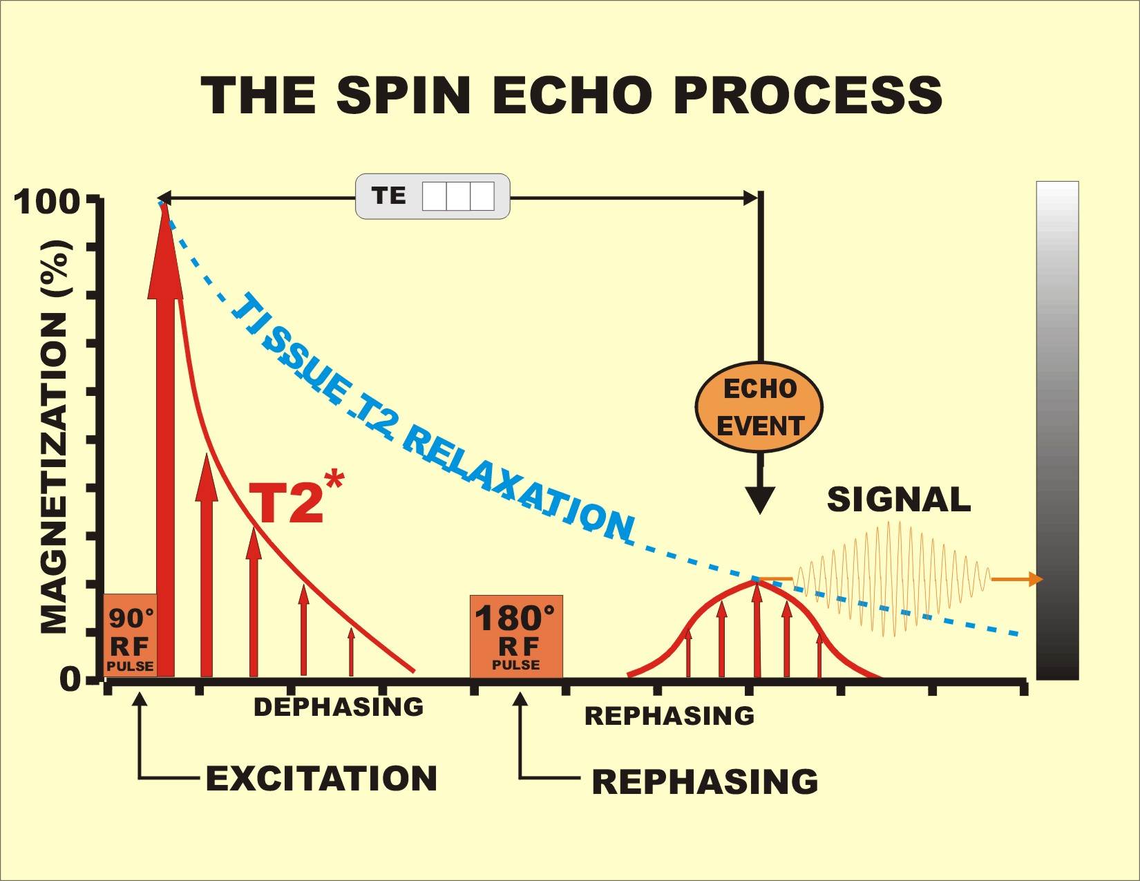 Inversion Recovery Spin Echo Pulse Sequence Inversion Recovery Spin Echo Pulse Sequence